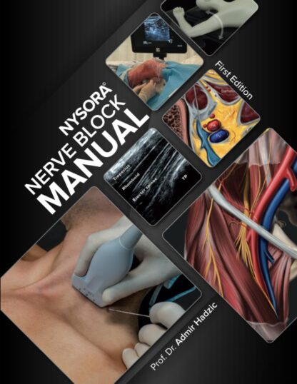 NYSORA Nerve Block Manual: 1st Edition (PDF Instant Download)